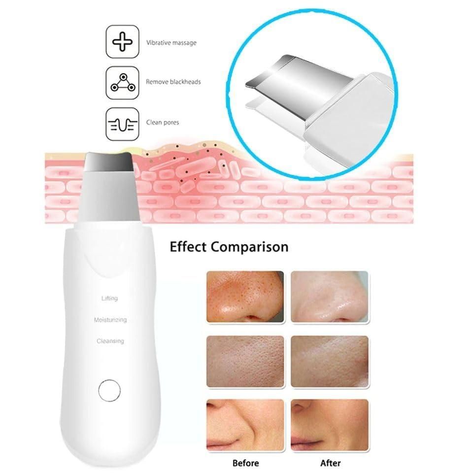 Ultrasonic Facial Kit White Heads And Blackhead Remover Removal Tool